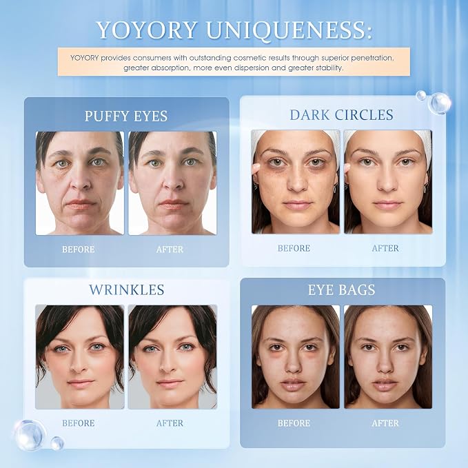 Under Eye Patches for Dark Circles & Puffy Eyes- 60 Hydrogel Eye Mask Patches - Image 2