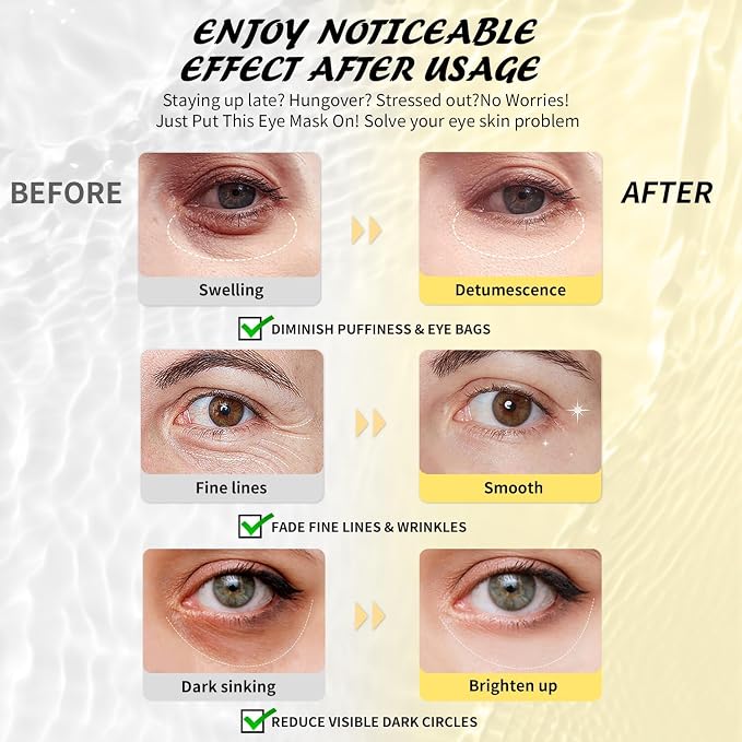 Maskiss Under Eye Patches, 24K Gold, Hyaluronic Acid, Aloe Vera Eye Masks - Image 3