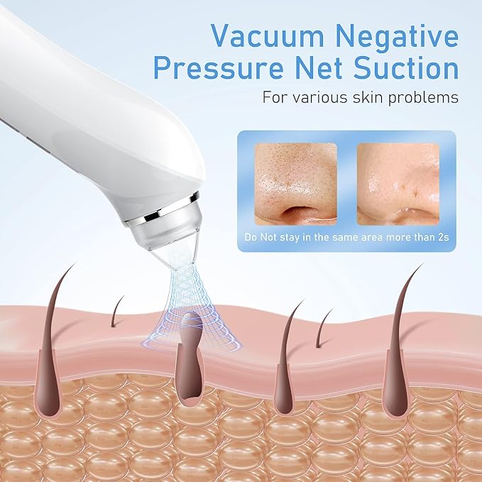 Facial Pore Blackhead Remover Vacuum, 1080P Camera Blackhead Remover, 20x Zoom - Image 5