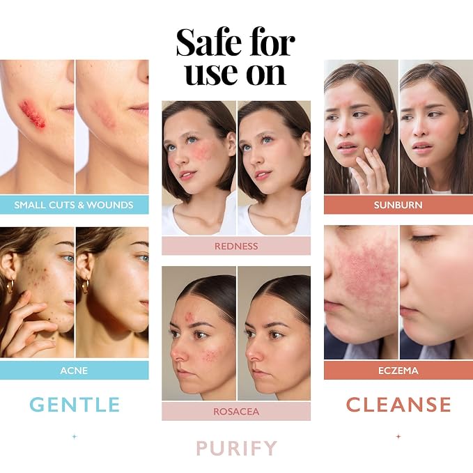 Hypochlorous Acid Spray for Face and Skin; Facial Cleanser | 2oz Face Mist - Image 3
