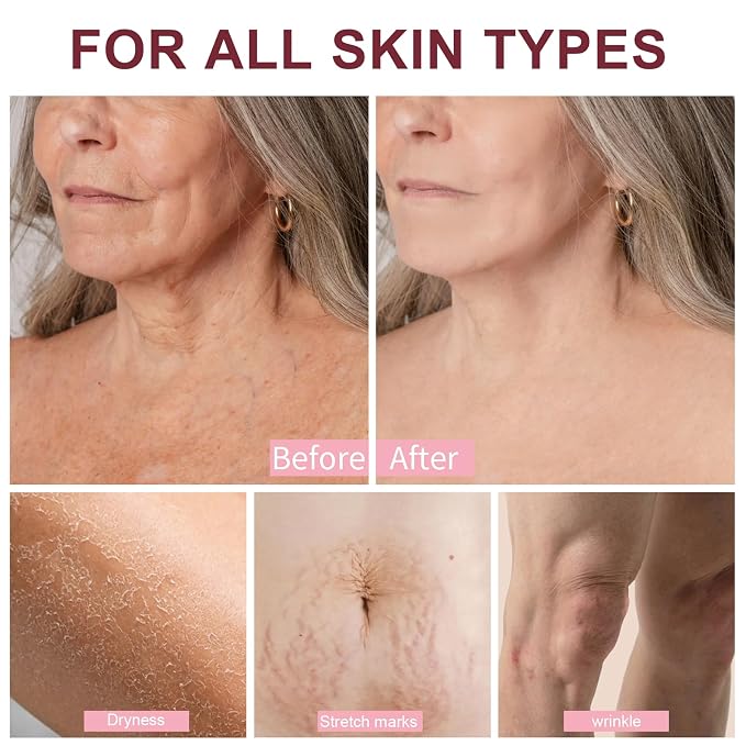 Mythic Body Oils for Women Skin Tightening Body Firming Oil Scented for Dry - Image 7
