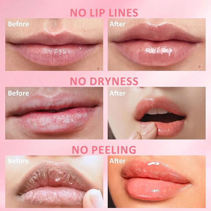 DMSKY 12 PCS Bee Lip Balm Lip Mask Honey Pot, Propolis Sleeping Lip Mask - Image 6
