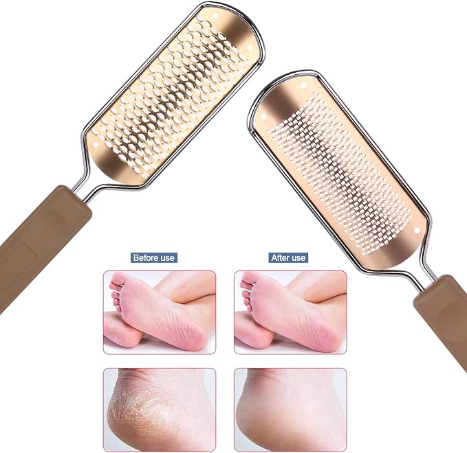 2 Pack Foot File & Rasp Callus Remover - Image 6