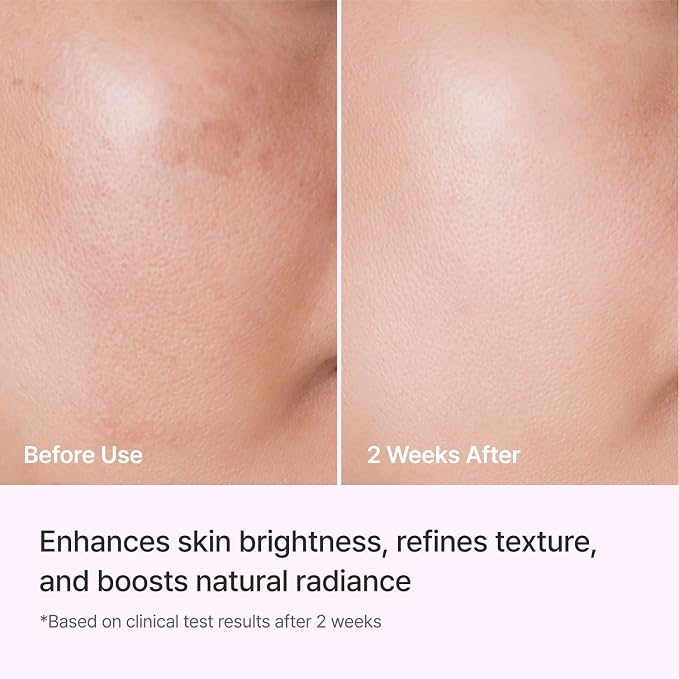 REJURAN® Triple Radiance Ampoule 50ml – DOT™ c-PDRN 0.5% Serum - Image 5