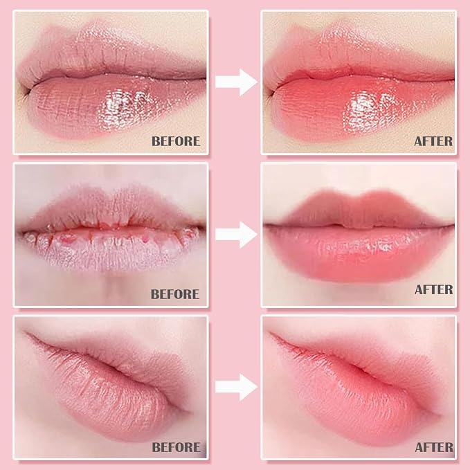 4Pcs Bee Lip Balm Honey Pot, Strawberry, Watermelon, Apple Lime, Honey Lip Balm - Image 7