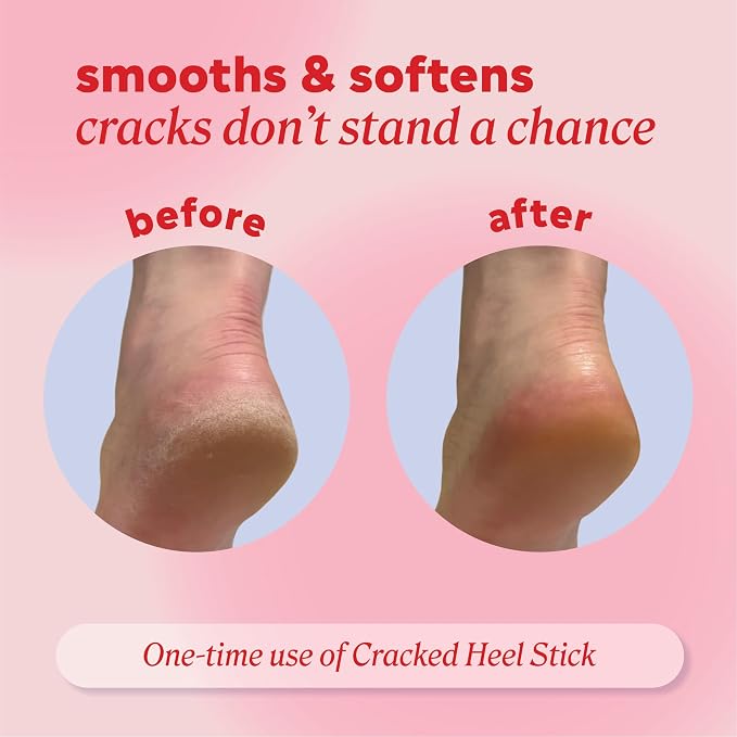 Onyx Professional Cracked Heel Repair Balm Stick, Lavender Scent, 1 Pack - Image 4