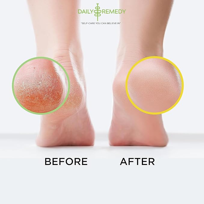 DAILY REMEDY 4-Pack Foot Soak Set - Image 5