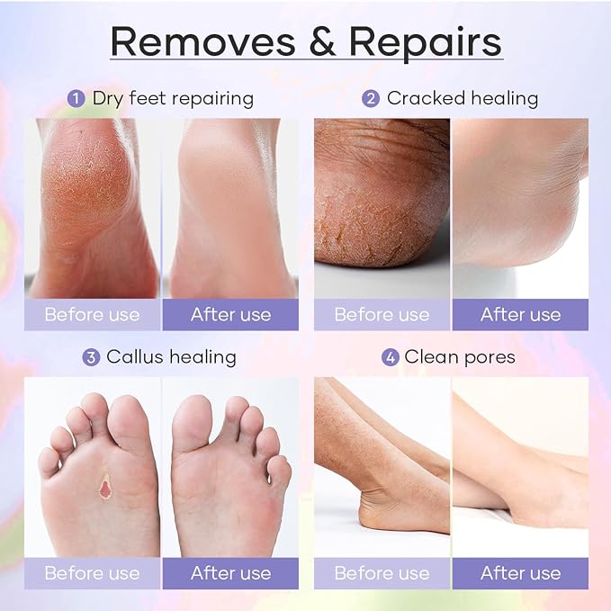 Deluxe 6 Step Pedicure Kit - Image 9