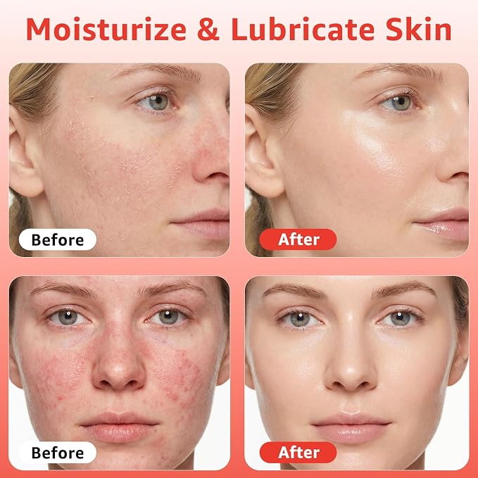 Red Light Therapy Serum, Vitamin E Redlight Serum - Image 2