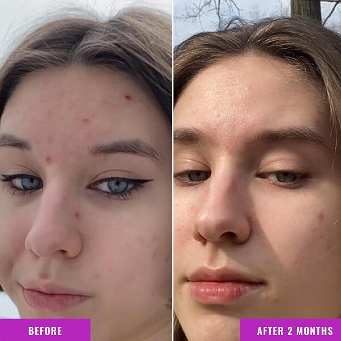 Good Molecules Niacinamide Serum - Image 4