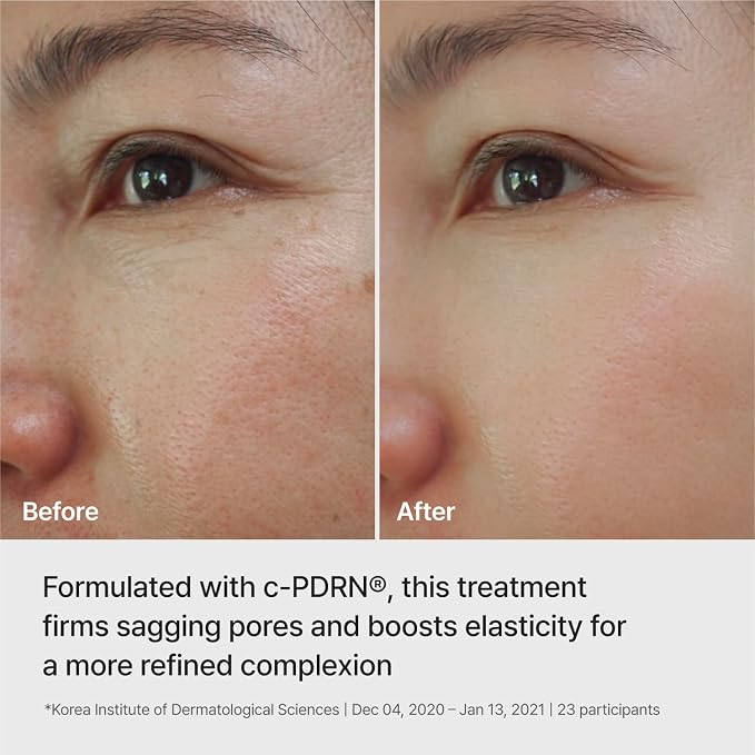 REJURAN® Ampoule Infused Lifting Mask, DOT™ c-PDRN® – Firming & Pore-Tightening - Image 4