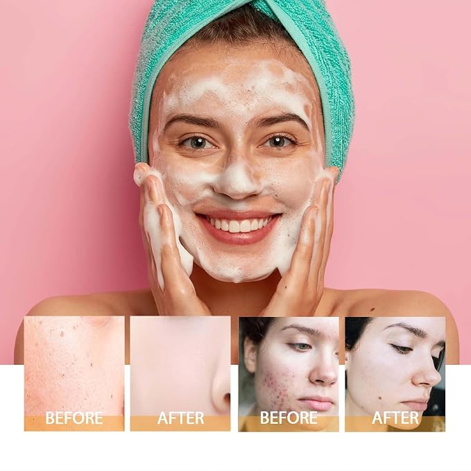 Turmeric Foaming Face Wash, Deep Cleansing Exfoliating Glow Wash Turmeric - Image 2