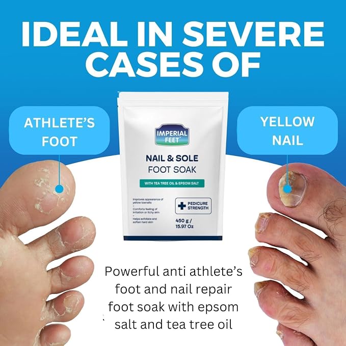 Imperial Feet Epsom Salt Foot Soak-Toenail Repair, Fungus Athletes Foot - Image 7