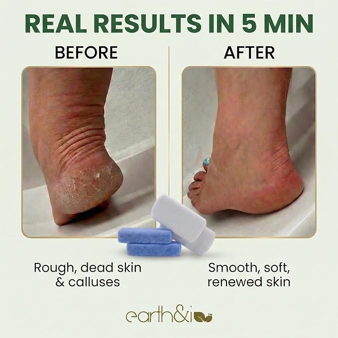 Earth & I Pumice Stone for Feet – 4-Pack Callus Remover Set | 2 Coarse + 2 Fine - Image 2