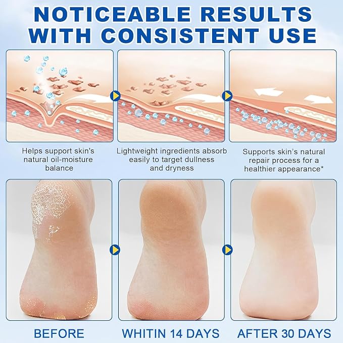 60% Urea Foot Cream Stick Plus 2% Salicylic Acid - Image 6