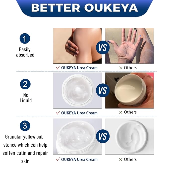 OUKEYA Urea Cream 42% plus Salicylic Acid 2% Net 350g - Image 6