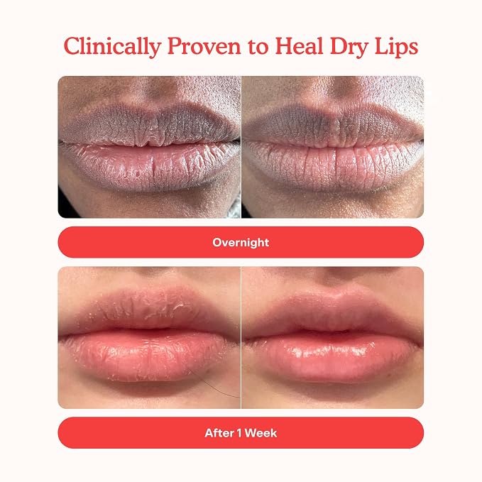 Tower 28 LipSoftie Tinted Lip Balm Treatment - Image 3
