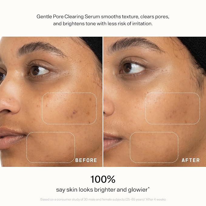 VERSED Skin Refine Gentle Pore Clearing Serum | Exfoliating Facial Serum - Image 11