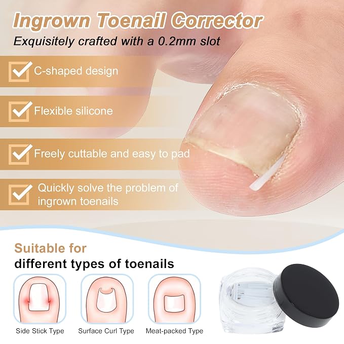 VOCOSTE Ingrown Toenail Correction Kit, Toe Nail Corrector Tools - Image 2