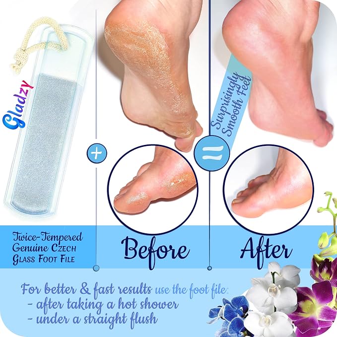 GLADZY Czech Glass Foot File Callus Remover – Double Sided Etched, Different - Image 4