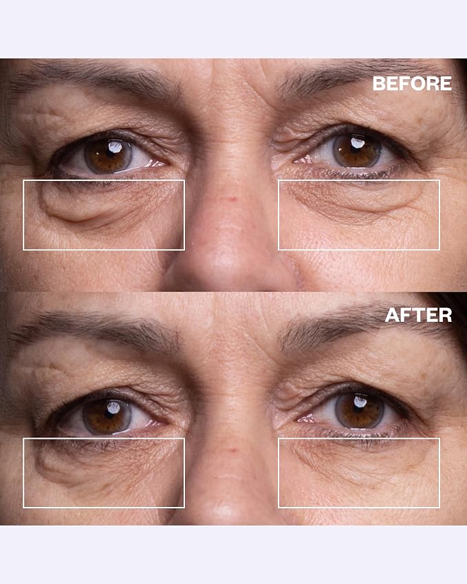 Wrinkles Schminkles Under Eye Patches - Image 3