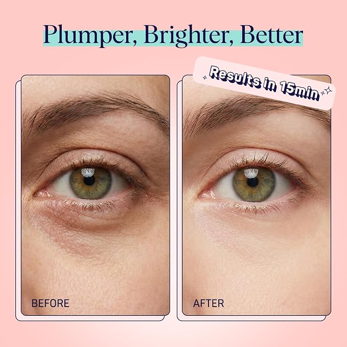 SpaLife Watermelon Cooling Eye Pads, Mothers Day Gifts, 48 Hydrating Under Eye - Image 4