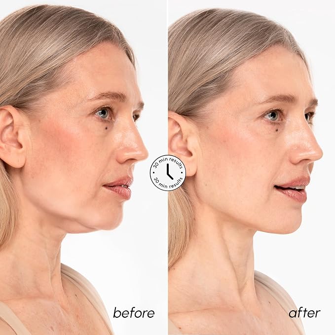 MAREE V Line Lifting Mask with 24K Gold – Deep Collagen Face Mask - Image 5
