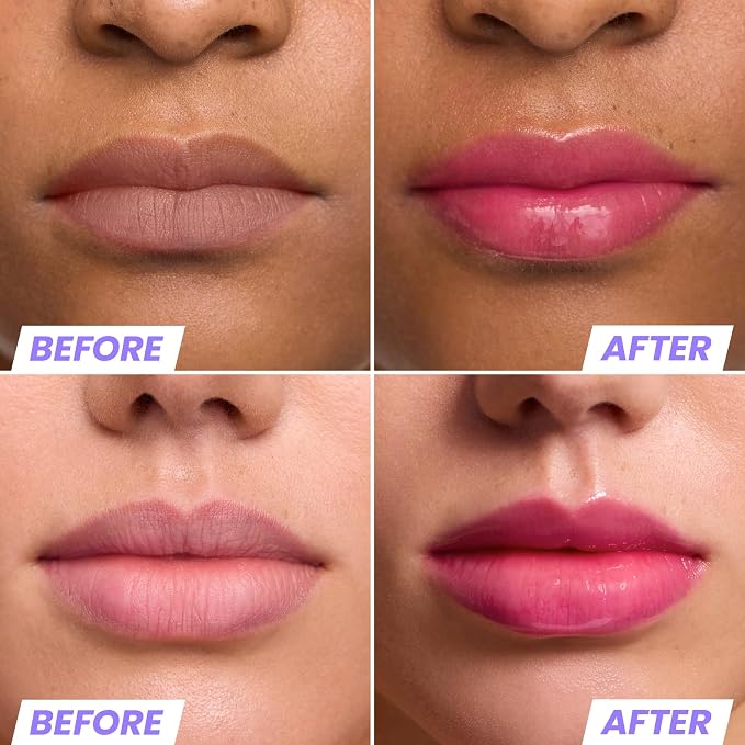 Wonderskin Lip Oil Rehab Serum - Image 2