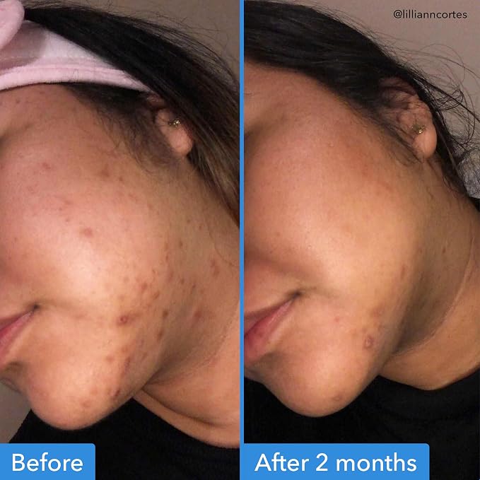 Good Molecules Discoloration Correcting Serum Pack 2 – 75 ml / 2.5 fl oz Each | - Image 3