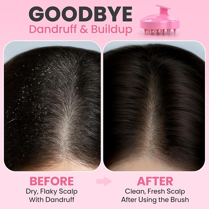 RELAXXO Scalp Massager Hair Growth – Exfoliator & Hair Scrubber - Image 3