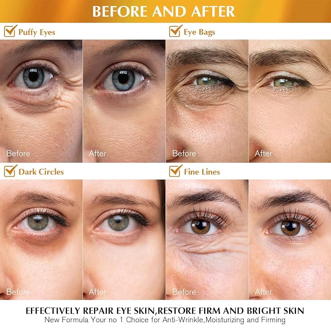 Enaskin Naturals Under Eye Patches Dark Circles Under Eye Masks - Image 3