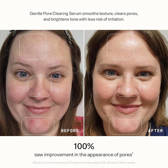 VERSED Skin Refine Gentle Pore Clearing Serum | Exfoliating Facial Serum - Image 12