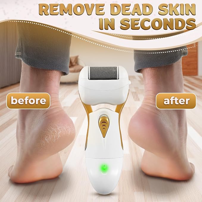 Electric Callus Remover for Feet – Electric Foot Filer - Image 6