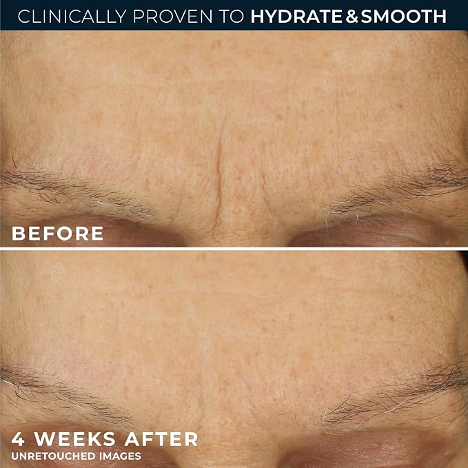 RoC Retinol Correxion Max Daily Hydration Anti-Aging Face Moisturizer - Image 5