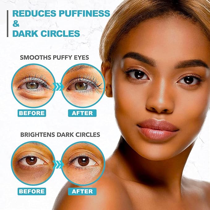 Under Eye Patches For Puffy Eyes And Dark Circles - Image 6