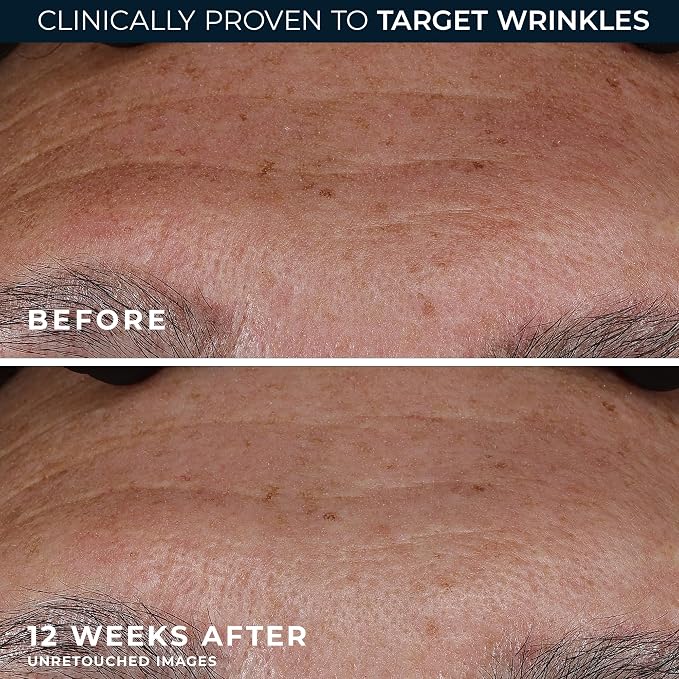 RoC Retinol Correxion Deep Wrinkle Retinol Face Serum - Image 5
